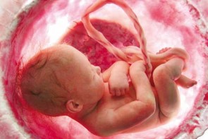 "جنین" چندماهه به ارزش 2 میلیون تومان!