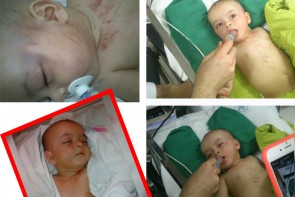 عکس های دلخراش از آزار نوزاد 5 ماهه در رشت / پرونده در دادسر تحت رسیدگی است+تصاویر