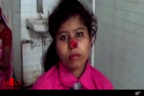 مرد هندی بینی همسرش را گاز گرفت و کند + فیلم